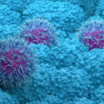 Pancreatic cancer drug daraxonrasib from Revolution Medicines succeeds in trial